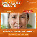 Cosmedica Skincare Vitamin C Serum for Face with Hyaluronic Acid – Anti Aging Serum for Dark Spots, Fine Lines, Wrinkles – Hydrating Collagen Booster for Women & Men 3
