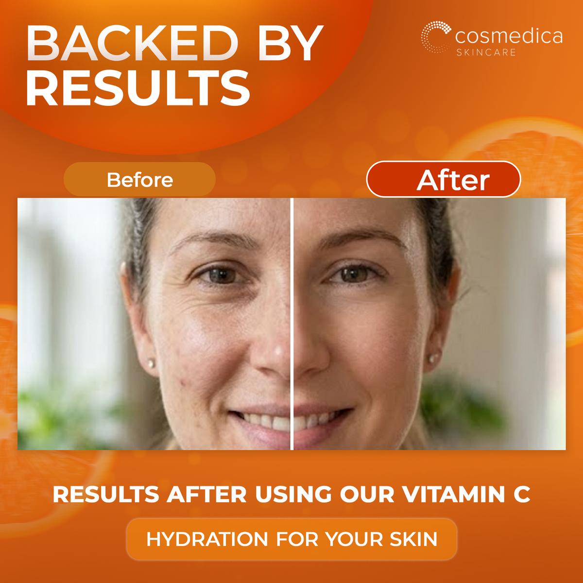 Cosmedica Skincare Vitamin C Serum for Face with Hyaluronic Acid – Anti Aging Serum for Dark Spots, Fine Lines, Wrinkles – Hydrating Collagen Booster for Women & Men