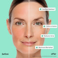 Redness Soothing Azelaic Acid Serum 4