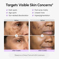 Face & Body Serum for Dark Spots 3