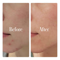 Clear System Full Routine 4