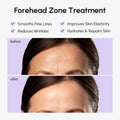 Anti-Wrinkle Forehead Patches 3