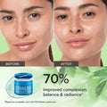 Glycolic Acid Exfoliating Pads 5