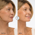 Hyaluronic Acid V-line Lifting Mask 3