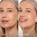 Pro-Retinol Neck Lifting Cream Massager 5