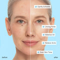 Glycolic & Salicylic Acid Peel Pads 5