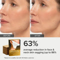 24K Gold V-Line Lifting Mask 20 PCS 7