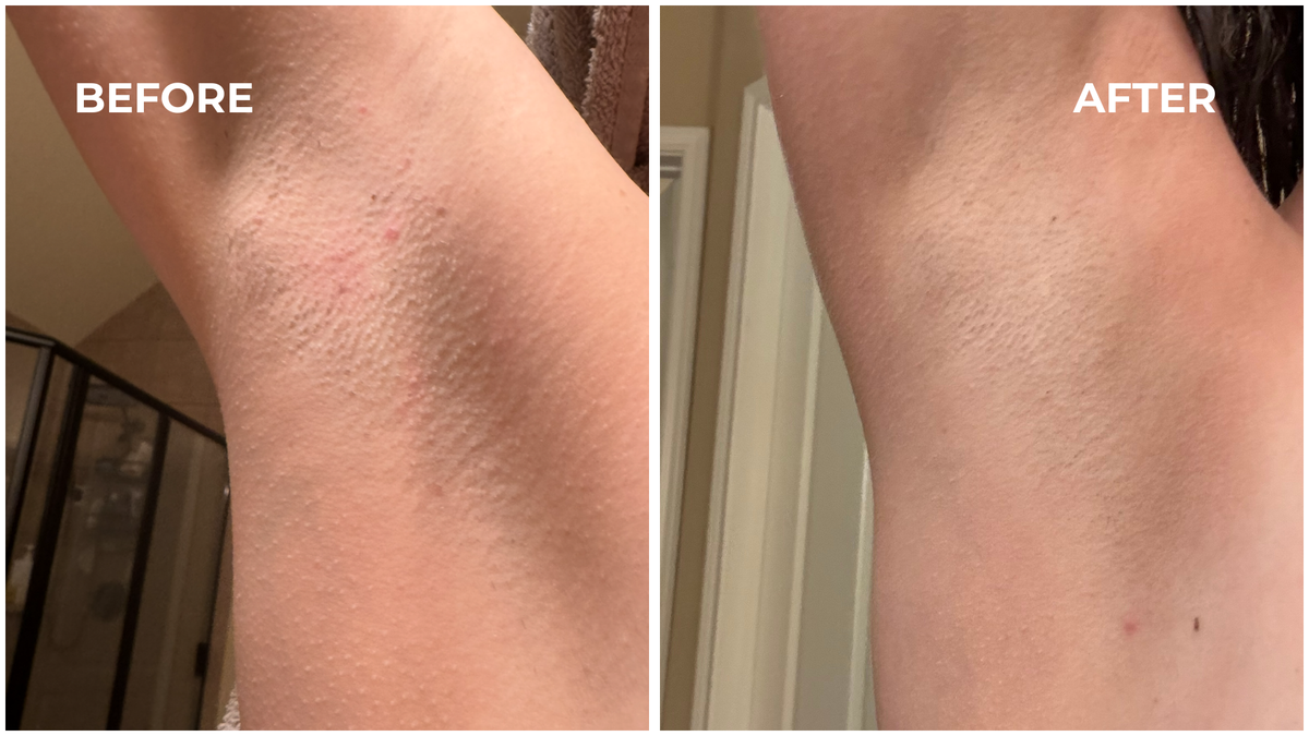 Bikini Oil
