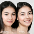 Pimple & Acne Patches 3