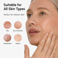 Azelaic Acid Cream for Sensitive Skin 6