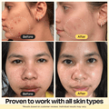Vitamin C Clay Mask 4