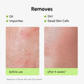 Daily Glow Exfoliating Toner 5