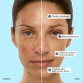 Face Polishing Scrub & Exfoliator 3