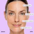 Dark Spot Corrector 4