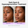 Dark Spot Corrector 5