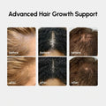 4-in-1 Hair Growth Spray 3
