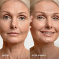 Pro-Retinol Neck Lifting Cream Massager 8