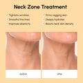 Lifting Neck Wrinkle Patches 3