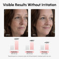 Firming & Renewing PDRN Serum 4