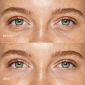 Pink Eye Patches for Puffy Eyes 4