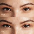 Pink Eye Patches for Puffy Eyes 6