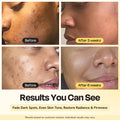 Superactive Serum 4
