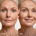24K Gold V-Line Lifting Mask 3