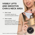 24K Gold V-Line Lifting Mask 6