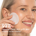 Witch Hazel Clearing Pads 2