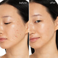 Witch Hazel Clearing Pads 3