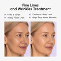 Anti-wrinkle Tape Patches 3